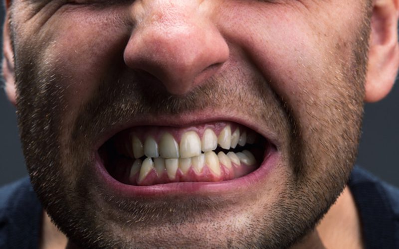  El bruxismo un apretar de dientes cuando duerme, puede ser peligroso