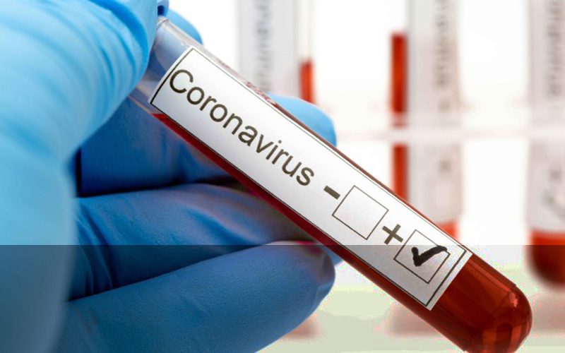  A siete se elevó el caso de coronavirus en la capital del Meta