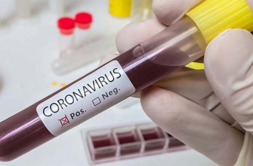  Soldado muerto por coronavirus en el Ariari será incinerado de acuerdo a protocolos por covid-19