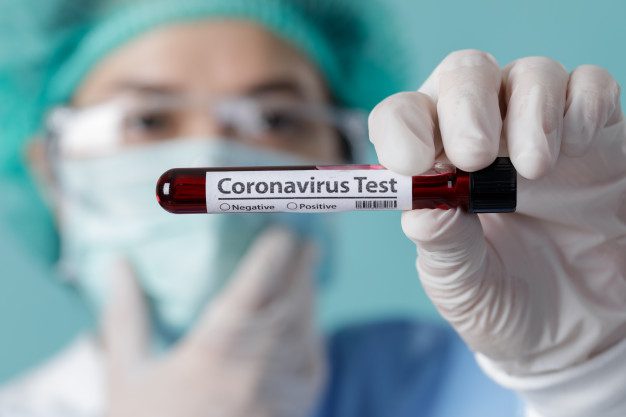  Si no se cumplen medidas sanitarias el coronavirus se extenderá causando tragedia y muerte