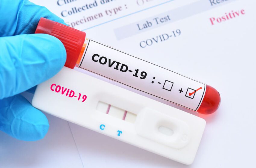  El gobierno una vez más advierte sobre el coronavirus y recomienda cumplir protocolos