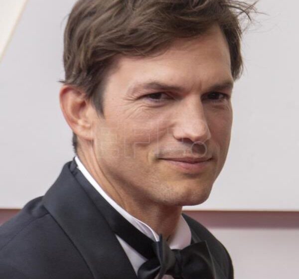  ASHTON KUTCHER – El actor Ashton Kutcher, a punto de perder la vista y el oído, por una «vasculitis»