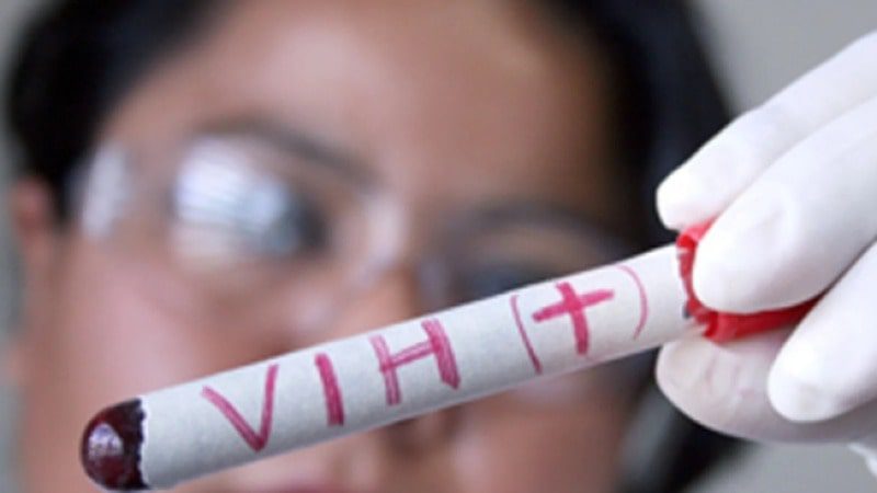  240 nuevos casos de infección por VIH reportaron en la secretaría de salud
